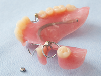 シッカリ噛める入れ歯を作るために～義歯（入れ歯）治療